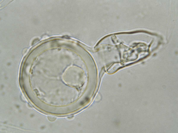 Obr. 1: Pohlavní orgány Phytophthora cambivora